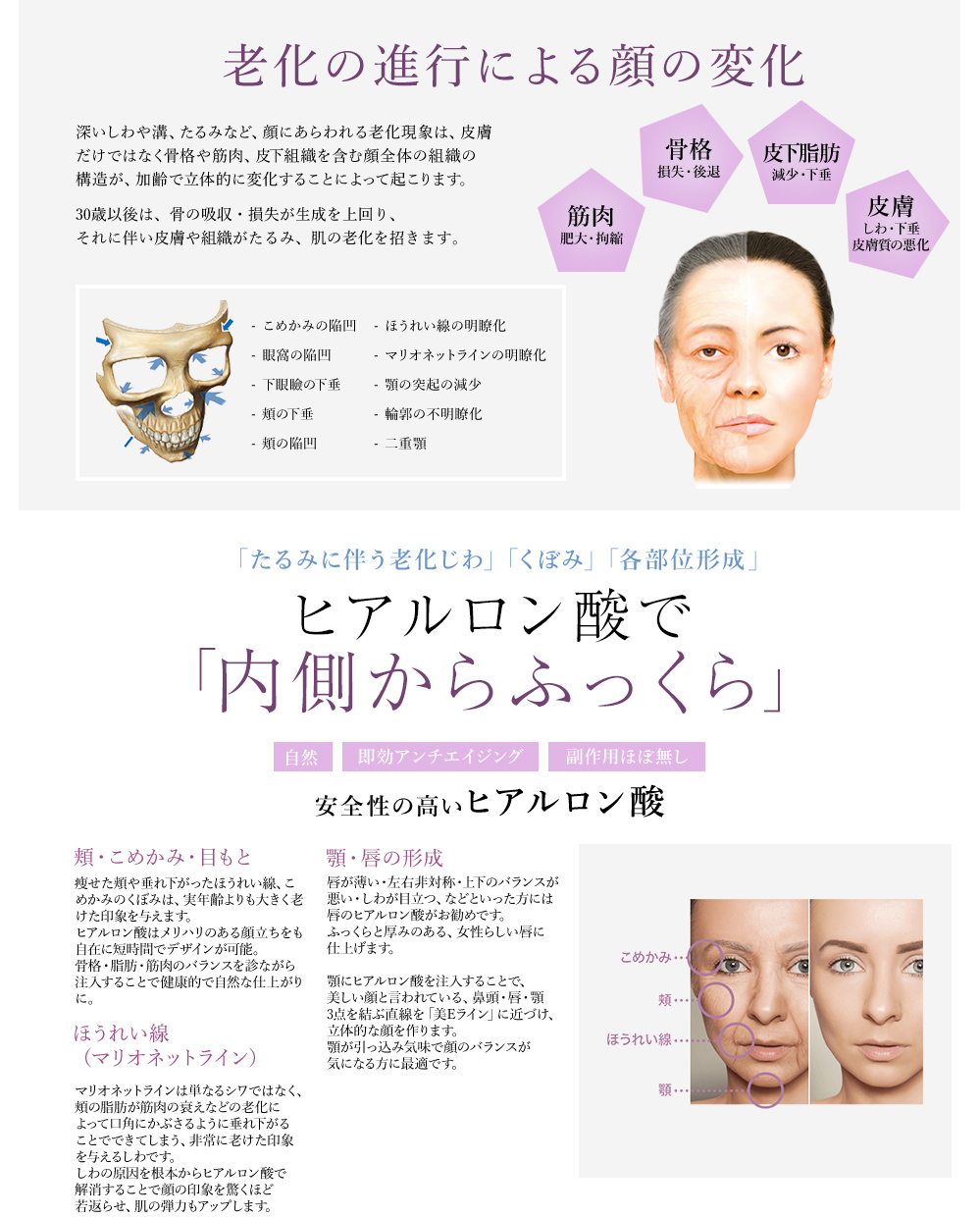 老化の進行による顔の変化 ヒアルロン酸で「内側からふっくら」
