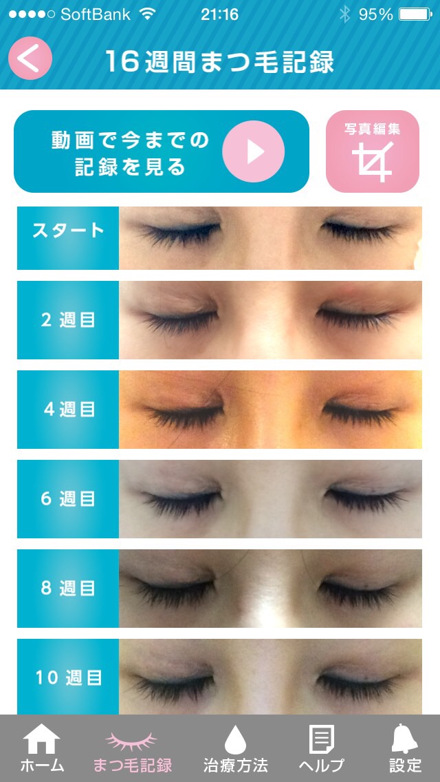 【まつ毛育毛薬】グラッシュビスタモニターbefore and after