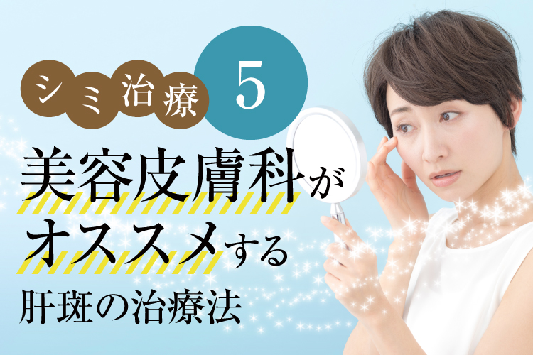 シミ治療５（美容皮膚科がオススメする肝斑の治療法）