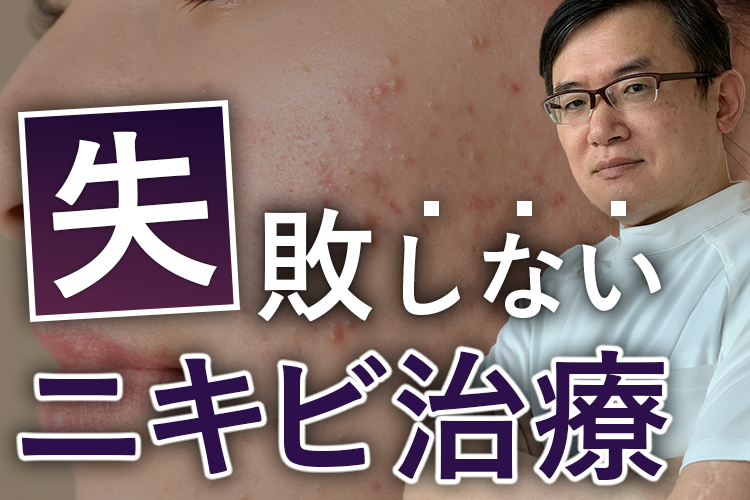 知らないとまずい!?治りにくいニキビの正しい対処法