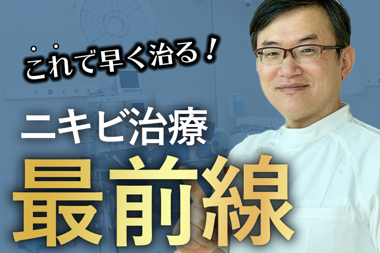 しつこいニキビを撲滅！ニキビ治療の最前線