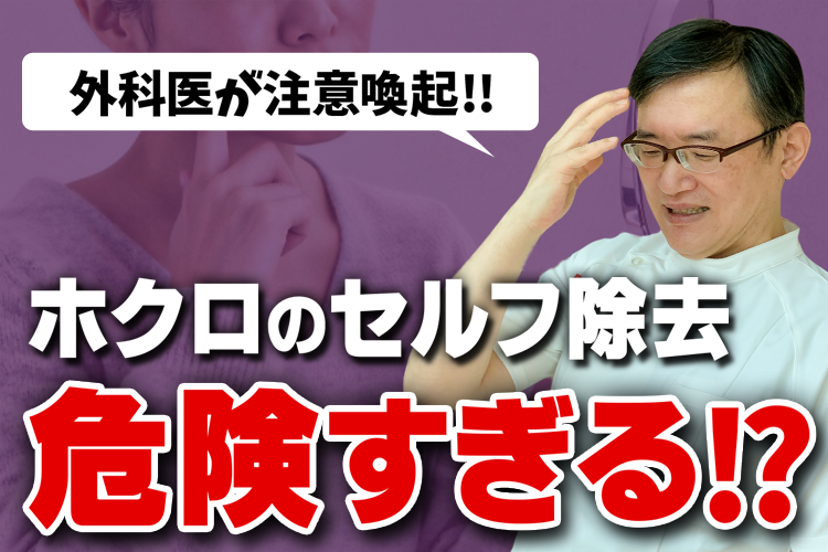 ほくろのセルフ除去は危険すぎる！？