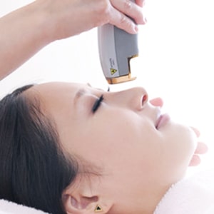 ニキビレーザー