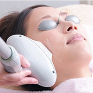 IPL光治療（ライムライト）