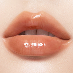 ヒアルロン酸注射(くちびる)