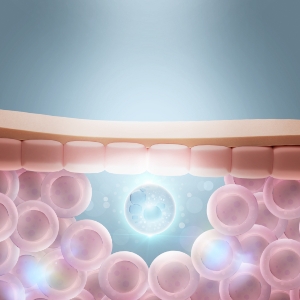 ピコフラクショナル(PicoWay)