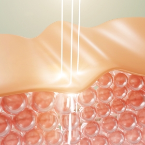 ピコトリプル(PicoWay)