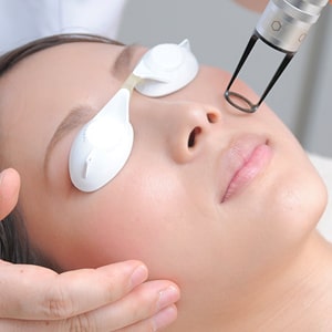 Qスイッチルビーレーザー