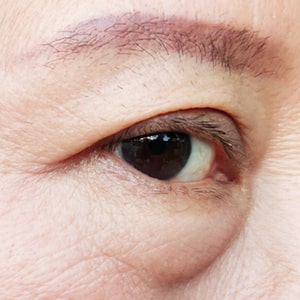 サーマクール・アイ