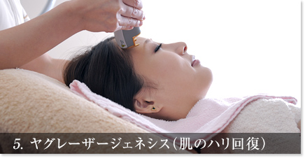 5. ヤグレーザージェネシス（肌のハリ回復）