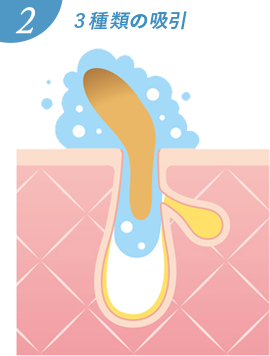 3種類の吸引