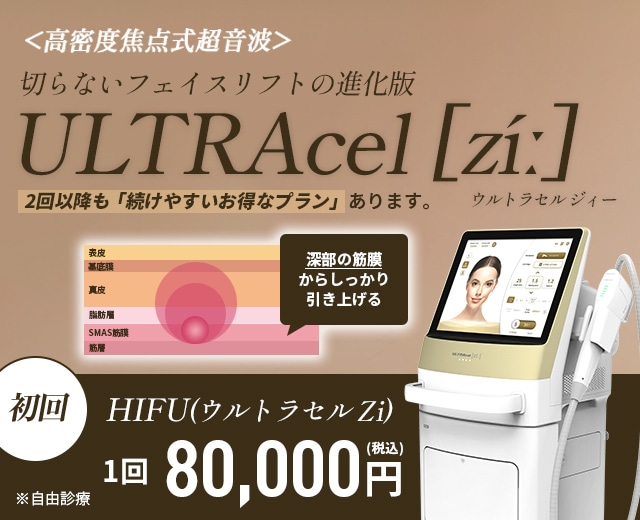 ウルトラセルZi