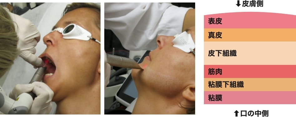 フォトナ4Dとは？