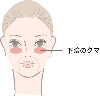 スムースリフト（SmoothLiftin™）