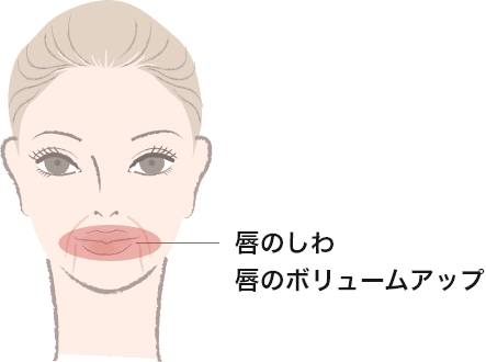 SupErficial&trade;（スムースピール）