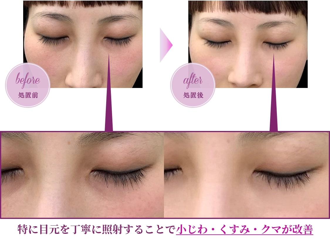 ジェネシス治療症例