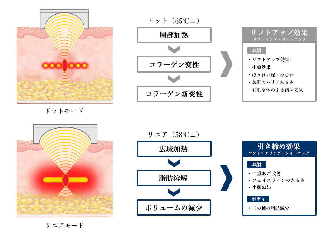 「0.5mm」単位で照射深度を調整可能に