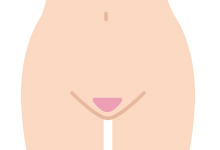 デザイン脱毛は、ご希望の形・毛量によって回数が大きく変わりますが、10回以上必要な場合がほとんどです