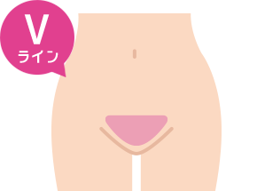 Vライン
