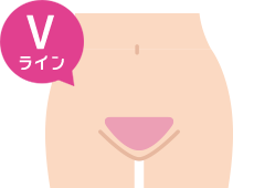 Vライン